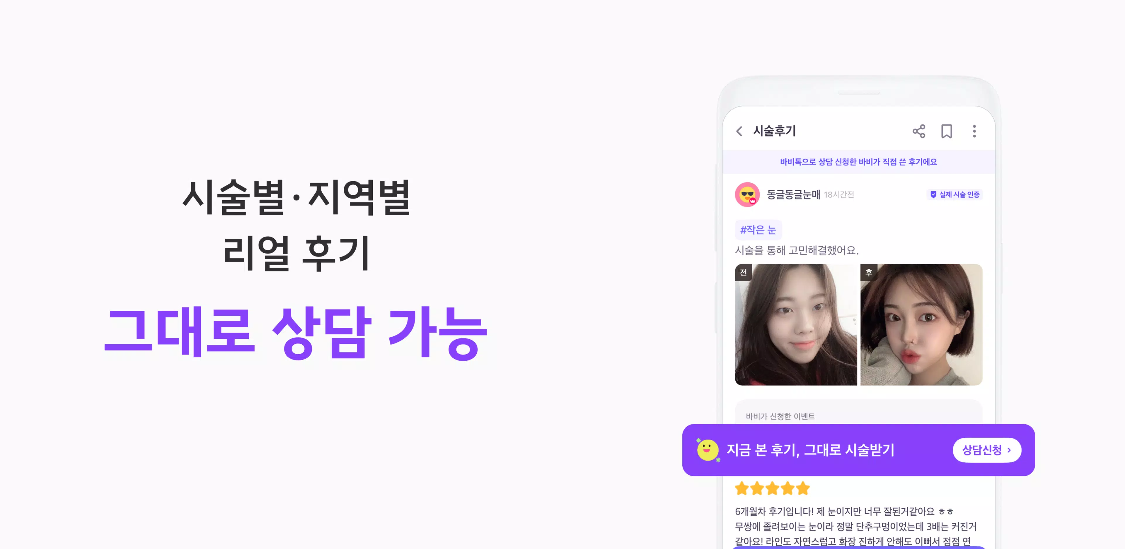 바비톡 - 성형 시술 성형외과 피부과 병원예약 성형어플 Captura de tela 3
