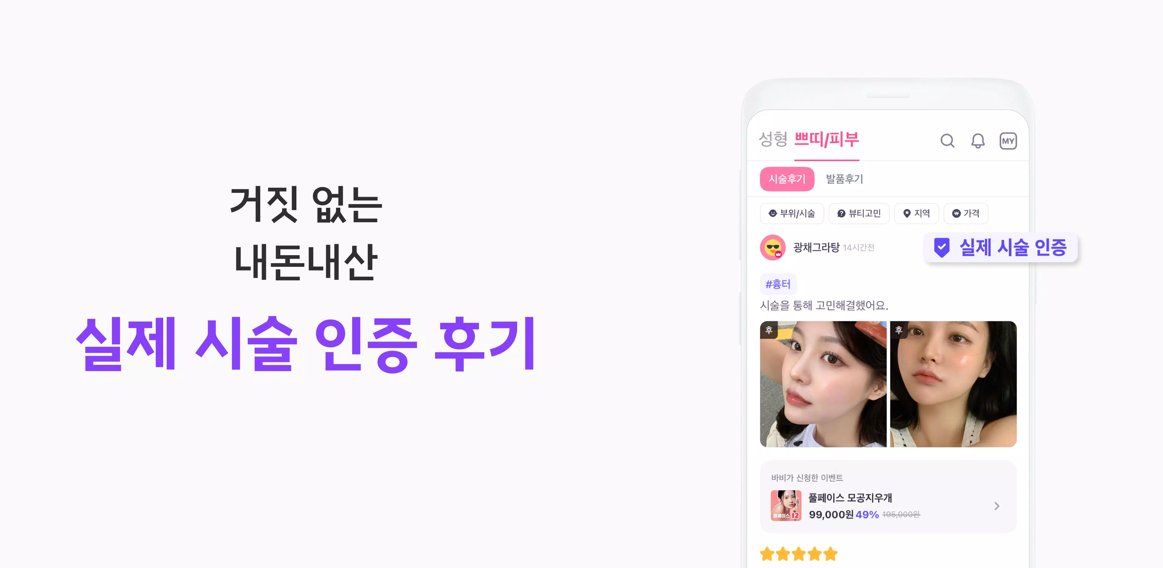바비톡 - 성형 시술 성형외과 피부과 병원예약 성형어플 Captura de tela 2